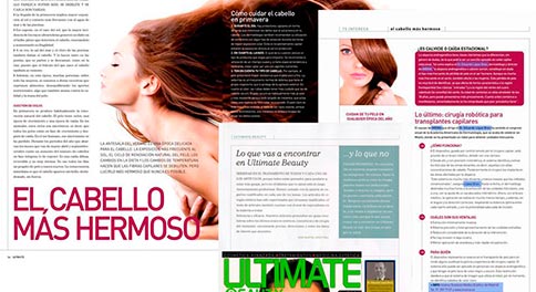 Trasplante-de-pelo.-Dr.-Eduardo-López-Bran.-ULTIMATE-BEAUTY-mini