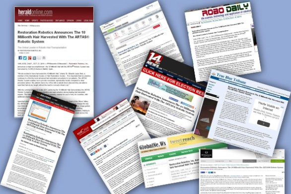 La prensa internacional publica que Clínica Imema realiza el trasplante de pelo 10 millones con el robot Artas