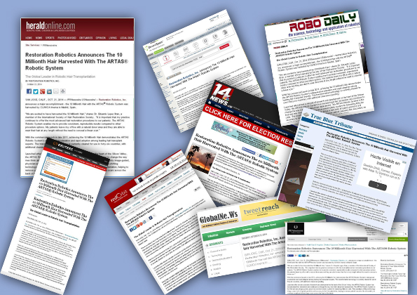 La prensa internacional publica que Clínica Imema realiza el trasplante de pelo 10 millones con el robot Artas