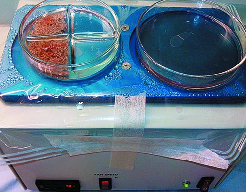 conservación unidades foliculares