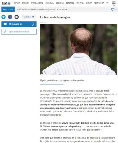 El Mundo - Rafa Nadal pérdida de pelo 2