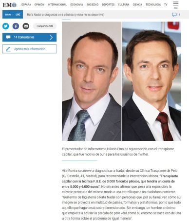 El Mundo - Rafa Nadal pérdida de pelo 3