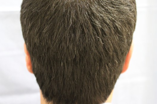 Ejemplo de buena zona dadora - Blog Eduardo López Bran