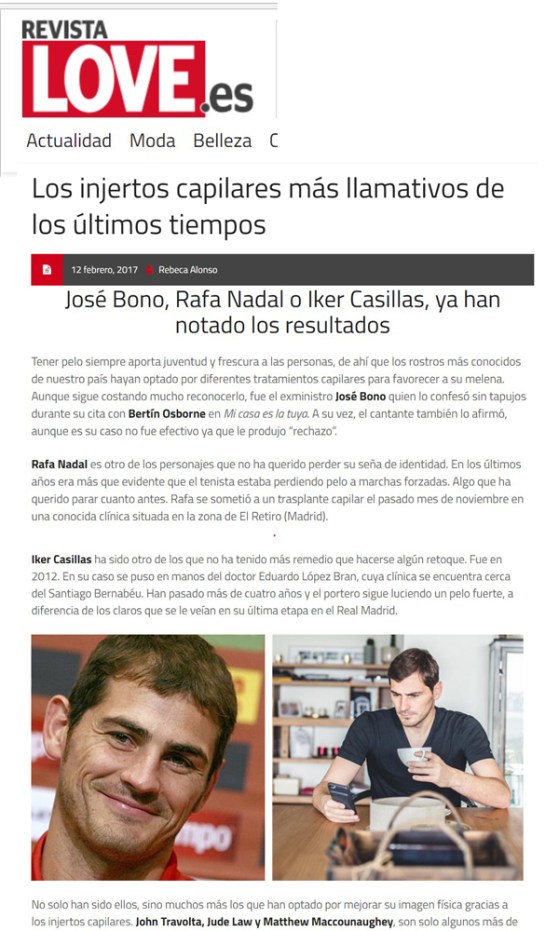 Injerto capilar famosos. Lopez Bran