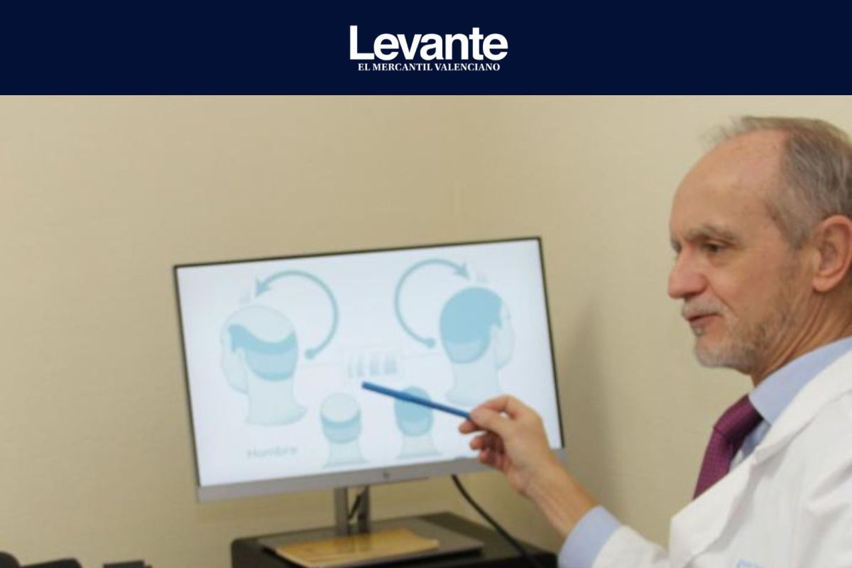 Células madre contra la calvicie: así es la innovadora «inyección» para regenerar el cabello